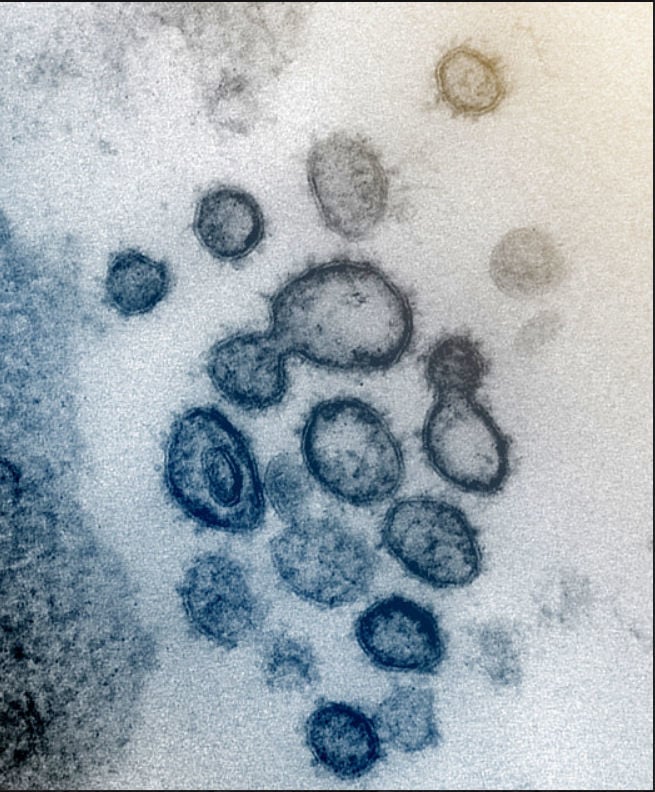 Novel Coronavirus SARS-CoV-2